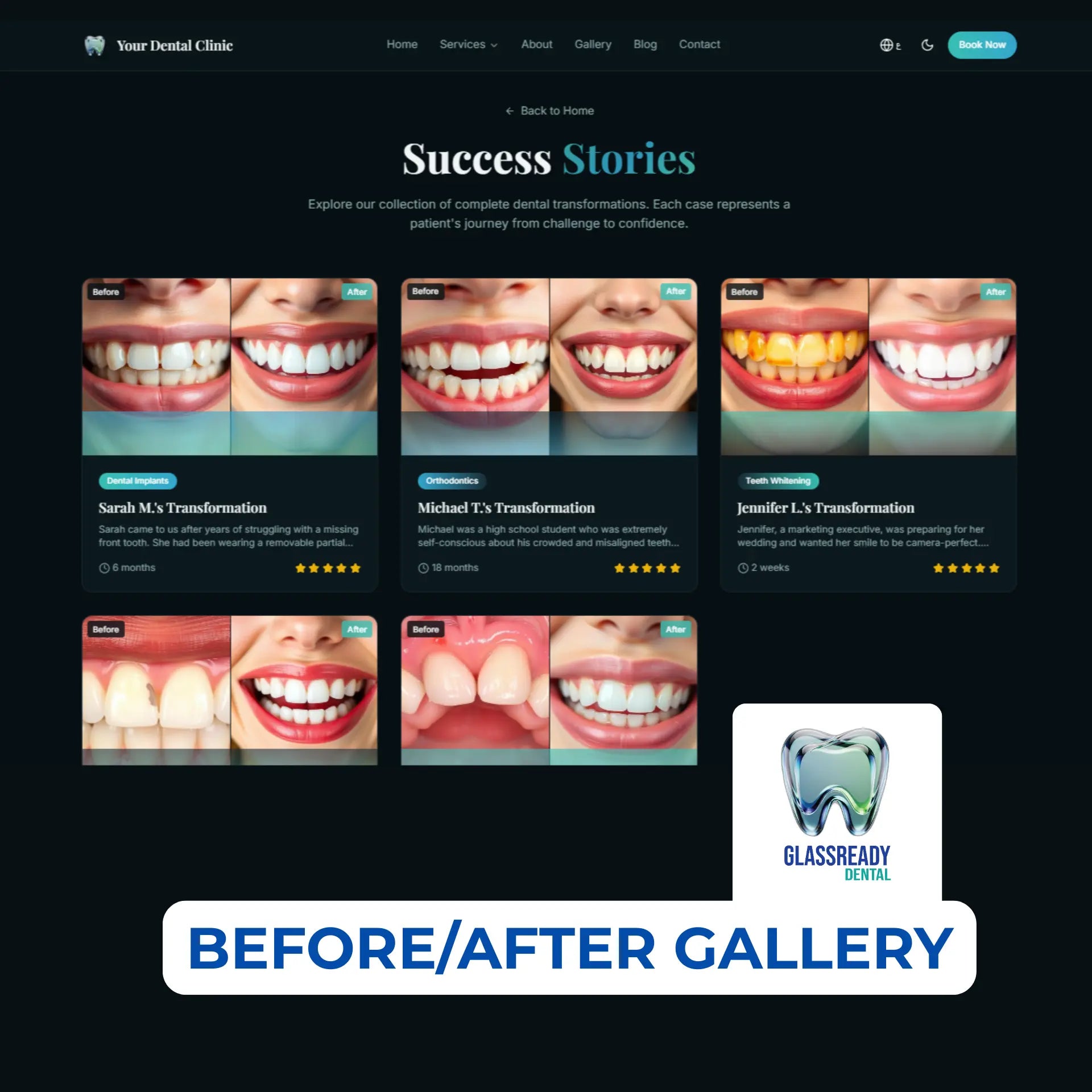GlassReady- Dental Clinic Website Template: Glassmorphism UI, React-Based The Smile Inc.